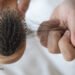 Stopping Hair Loss and Selling Hair Progress