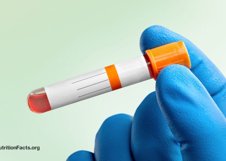 Preferrred vs. Regular Ldl cholesterol Ranges 
