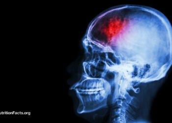 Fasting and Plant-Based mostly Diets for Migraines and Traumatic Mind Accidents 