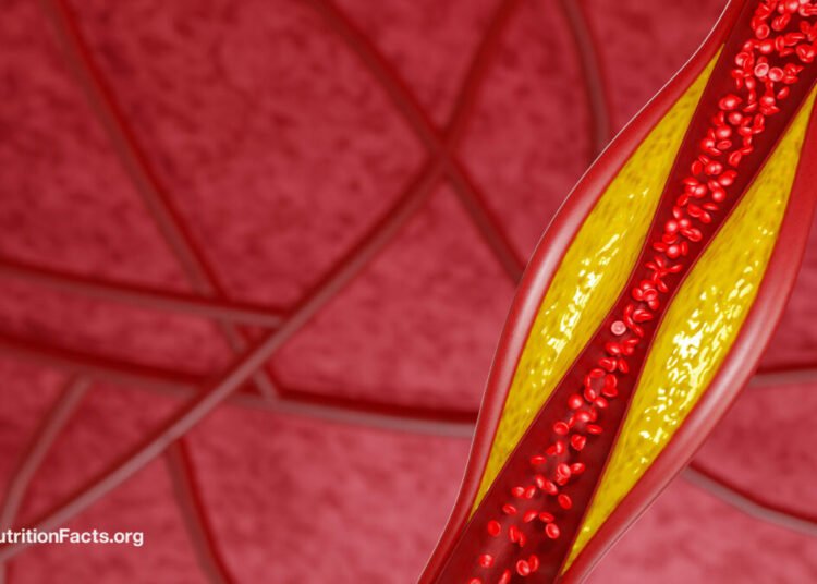 How Low Can LDL Ldl cholesterol Go on PCSK9 Inhibitors?