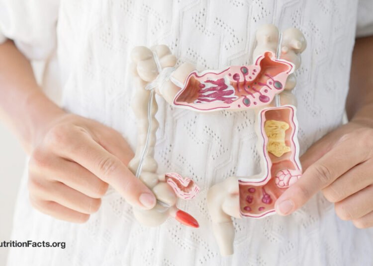 Which Meals Assist a Leaky Intestine?