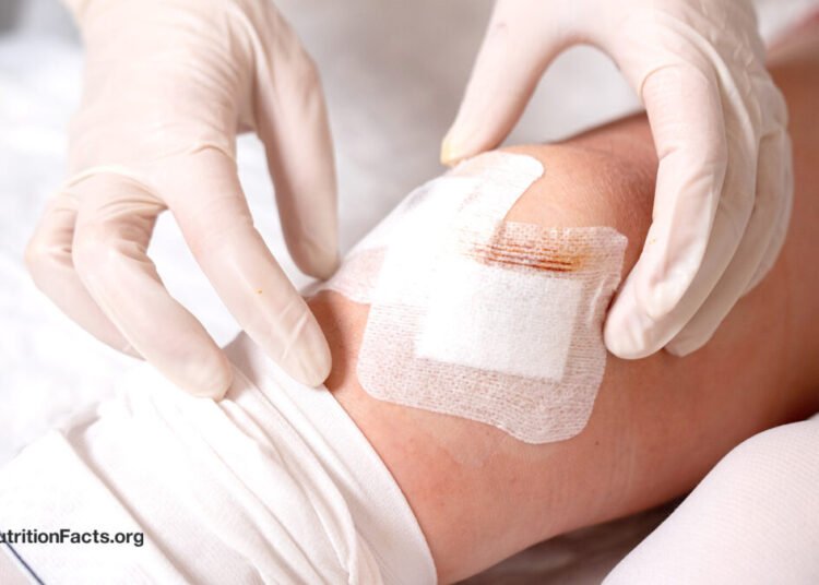 When the Repair Is an Phantasm