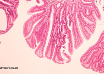 May Bovine Leukemia Virus be a Explanation for Breast Most cancers?